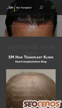 haartransplantation-blog.ch mobil Vorschau