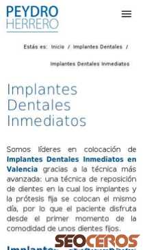 clinicapeydro.es/implantes-dentales/inmediatos-valencia mobil obraz podglądowy