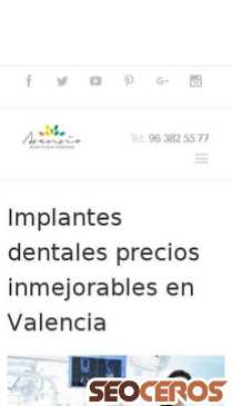 dentalasensio.com/implantes-3 mobil preview