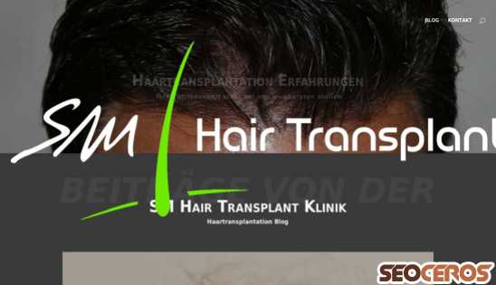 haartransplantation-blog.ch desktop vista previa