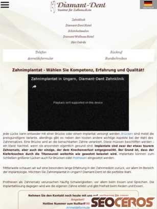 diamantdent.hu/de/zahnklinik/zahnbehandlungen/implantate-fuer-schoene-zaehne tablet Vorschau