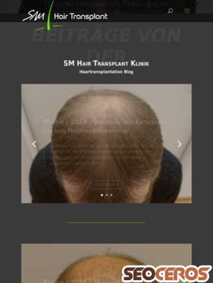 haartransplantation-blog.ch tablet náhled obrázku