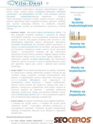 static.vita-dent.pl/implanty tablet förhandsvisning